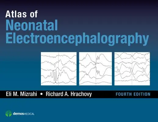 Atlas de l'électroencéphalographie néonatale - Atlas of Neonatal Electroencephalography