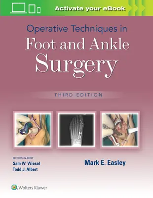Techniques opératoires en chirurgie du pied et de la cheville - Operative Techniques in Foot and Ankle Surgery