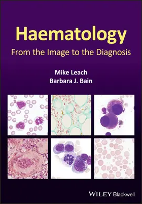 L'hématologie : De l'image au diagnostic - Haematology: From the Image to the Diagnosis