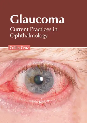 Glaucome : Pratiques actuelles en ophtalmologie - Glaucoma: Current Practices in Ophthalmology