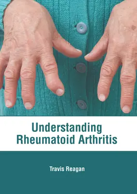 Comprendre la polyarthrite rhumatoïde - Understanding Rheumatoid Arthritis