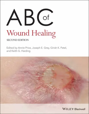 ABC de la cicatrisation des plaies - ABC of Wound Healing