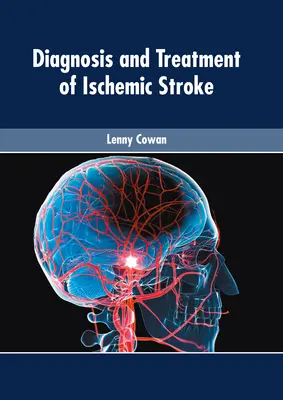Diagnostic et traitement de l'accident vasculaire cérébral ischémique - Diagnosis and Treatment of Ischemic Stroke