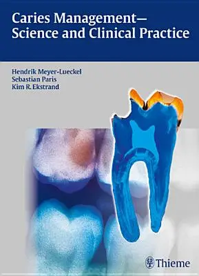 Gestion des caries - Science et pratique clinique - Caries Management - Science and Clinical Practice