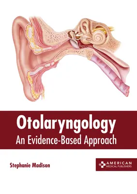Otolaryngologie : Une approche fondée sur des données probantes - Otolaryngology: An Evidence-Based Approach