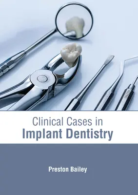 Cas cliniques en dentisterie implantaire - Clinical Cases in Implant Dentistry