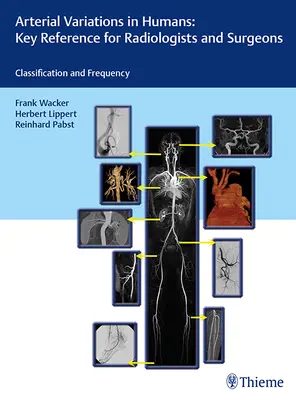 Variations artérielles chez l'homme : Référence clé pour les radiologues et les chirurgiens : Classifications et fréquence - Arterial Variations in Humans: Key Reference for Radiologists and Surgeons: Classifications and Frequency