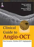 Guide clinique de l'angio-OCT : angiographie OCT non invasive et sans colorant - Clinical Guide to Angio-OCT: Non Invasive, Dyeless OCT Angiography