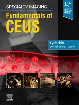 Imagerie spécialisée : Principes fondamentaux de l'imagerie - Specialty Imaging: Fundamentals of Ceus