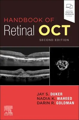Handbook of Retinal Oct : Tomographie par cohérence optique - Handbook of Retinal Oct: Optical Coherence Tomography