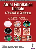 Mise à jour sur la fibrillation auriculaire : un manuel de cardiologie - Atrial Fibrillation Update: A Textbook of Cardiology