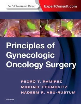 Principes de la chirurgie oncologique gynécologique - Principles of Gynecologic Oncology Surgery