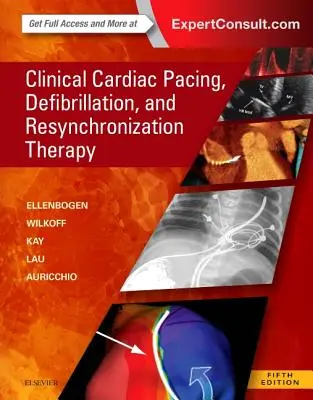 Stimulation cardiaque clinique, défibrillation et thérapie de resynchronisation - Clinical Cardiac Pacing, Defibrillation and Resynchronization Therapy