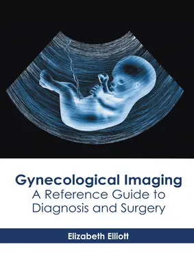 Imagerie gynécologique : Guide de référence pour le diagnostic et la chirurgie - Gynecological Imaging: A Reference Guide to Diagnosis and Surgery