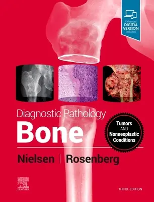 Pathologie diagnostique : Os - Diagnostic Pathology: Bone