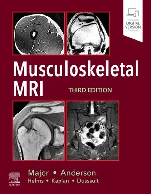 IRM musculo-squelettique - Musculoskeletal MRI