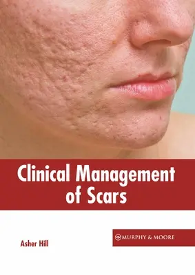 Gestion clinique des cicatrices - Clinical Management of Scars