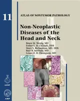 Maladies non néoplasiques de la tête et du cou - Non-Neoplastic Diseases of the Head and Neck