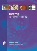 L'uvéite - Uveitis