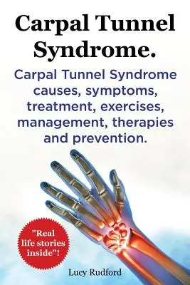 Syndrome du canal carpien. Syndrome du canal carpien : causes, symptômes, traitement, exercices, gestion, thérapies et prévention. Des histoires vraies à l'intérieur ! - Carpal Tunnel Syndrome. Carpal Tunnel Syndrome causes, symptoms, treatment, exercises, management, therapies and prevention. Real Life Stories Inside!