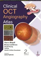 Atlas d'angiographie OCT clinique - Clinical OCT Angiography Atlas