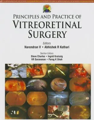 Principes et pratique de la chirurgie vitréo-rétinienne - Principles and Practice of Vitreoretinal Surgery