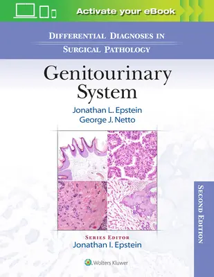 Diagnostics différentiels en pathologie chirurgicale : Système génito-urinaire - Differential Diagnoses in Surgical Pathology: Genitourinary System