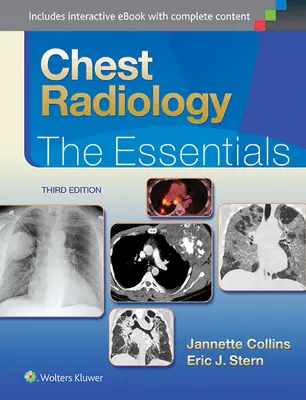 Radiologie thoracique : L'essentiel - Chest Radiology: The Essentials