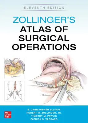 Atlas des opérations chirurgicales de Zollinger, onzième édition - Zollinger's Atlas of Surgical Operations, Eleventh Edition