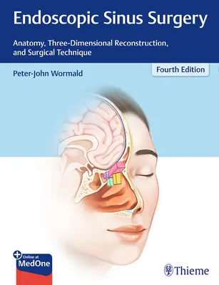 Chirurgie endoscopique des sinus : Anatomie, reconstruction tridimensionnelle et technique chirurgicale - Endoscopic Sinus Surgery: Anatomy, Three-Dimensional Reconstruction, and Surgical Technique
