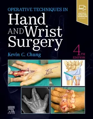 Techniques opératoires : Chirurgie de la main et du poignet - Operative Techniques: Hand and Wrist Surgery