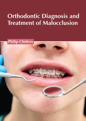 Diagnostic et traitement orthodontique de la malocclusion - Orthodontic Diagnosis and Treatment of Malocclusion