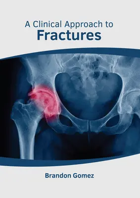 Approche clinique des fractures - A Clinical Approach to Fractures