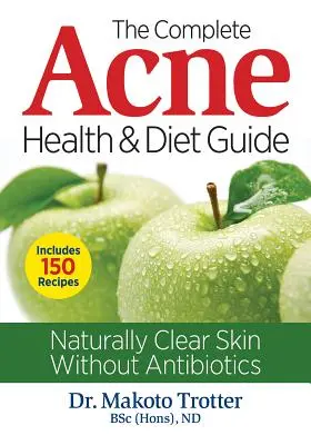 Le guide complet de la santé et du régime de l'acné : Une peau naturellement claire sans antibiotiques - The Complete Acne Health and Diet Guide: Naturally Clear Skin Without Antibiotics