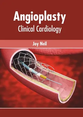 L'angioplastie : Cardiologie clinique - Angioplasty: Clinical Cardiology