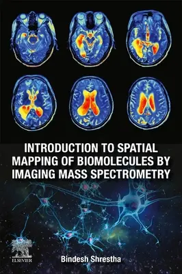 Introduction à la cartographie spatiale des biomolécules par spectrométrie de masse imageante - Introduction to Spatial Mapping of Biomolecules by Imaging Mass Spectrometry