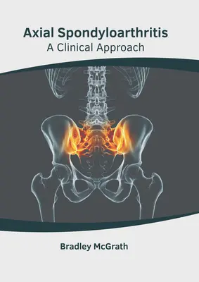 La spondylarthrite axiale : Une approche clinique - Axial Spondyloarthritis: A Clinical Approach