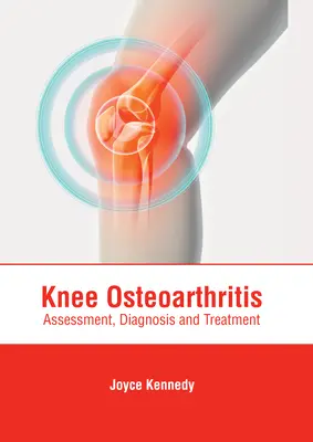 L'arthrose du genou : Évaluation, diagnostic et traitement - Knee Osteoarthritis: Assessment, Diagnosis and Treatment