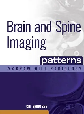 Les schémas d'imagerie du cerveau et de la colonne vertébrale : Imagerie du cerveau et de la colonne vertébrale - Brain and Spine Imaging Patterns: Brain & Spine Imaging