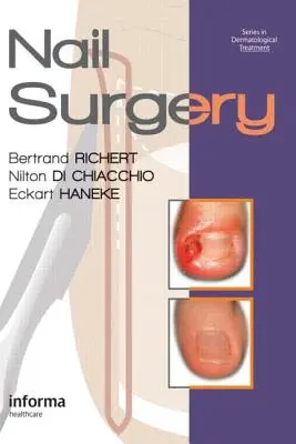 Chirurgie des ongles - Nail Surgery