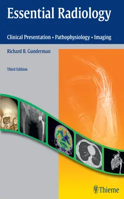 La radiologie essentielle : Présentation clinique - Physiopathologie - Imagerie - Essential Radiology: Clinical Presentation - Pathophysiology - Imaging