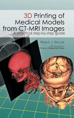 Impression 3D de modèles médicaux à partir d'images CT-MRI : Un guide pratique étape par étape - 3D Printing of Medical Models from CT-MRI Images: A Practical step-by-step guide