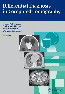 Diagnostic différentiel en tomographie informatisée - Differential Diagnosis in Computed Tomography