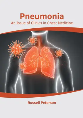La pneumonie : Un numéro de Clinics in Chest Medicine - Pneumonia: An Issue of Clinics in Chest Medicine