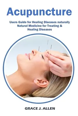 Acupuncture : Guide de l'utilisateur pour la guérison des maladies Médecine naturelle pour le traitement et la guérison des maladies - Acupuncture: Users Guide for Healing Diseases naturally Natural Medicine for Treating & Healing Diseases