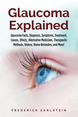 Le glaucome expliqué : Glaucome : faits, diagnostic, symptômes, traitement, causes, effets, médecines alternatives, méthodes thérapeutiques, histoire, - Glaucoma Explained: Glaucoma Facts, Diagnosis, Symptoms, Treatment, Causes, Effects, Alternative Medicines, Therapeutic Methods, History,