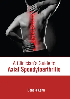 Guide du clinicien sur la spondylarthrite axiale - A Clinician's Guide to Axial Spondyloarthritis
