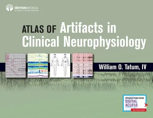 Atlas des artefacts en neurophysiologie clinique - Atlas of Artifacts in Clinical Neurophysiology