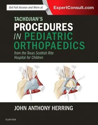 Tachdjian's Procedures in Pediatric Orthopaedics (Procédures de Tachdjian en orthopédie pédiatrique) : From the Texas Scottish Rite Hospital for Children - Tachdjian's Procedures in Pediatric Orthopaedics: From the Texas Scottish Rite Hospital for Children