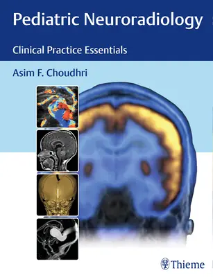 Neuroradiologie pédiatrique : L'essentiel de la pratique clinique - Pediatric Neuroradiology: Clinical Practice Essentials